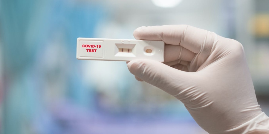 RAPID TEST: Διευκρινίζει το Υπουργείο Υγείας - Συνεχίζονται κανονικά τα test
